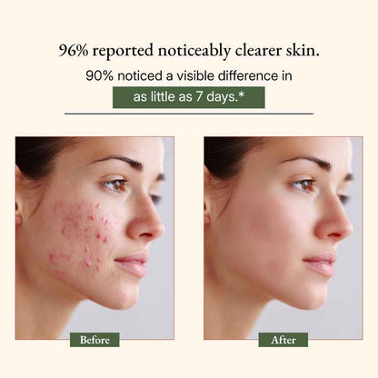 Ayurvedic Neem Soap Bar