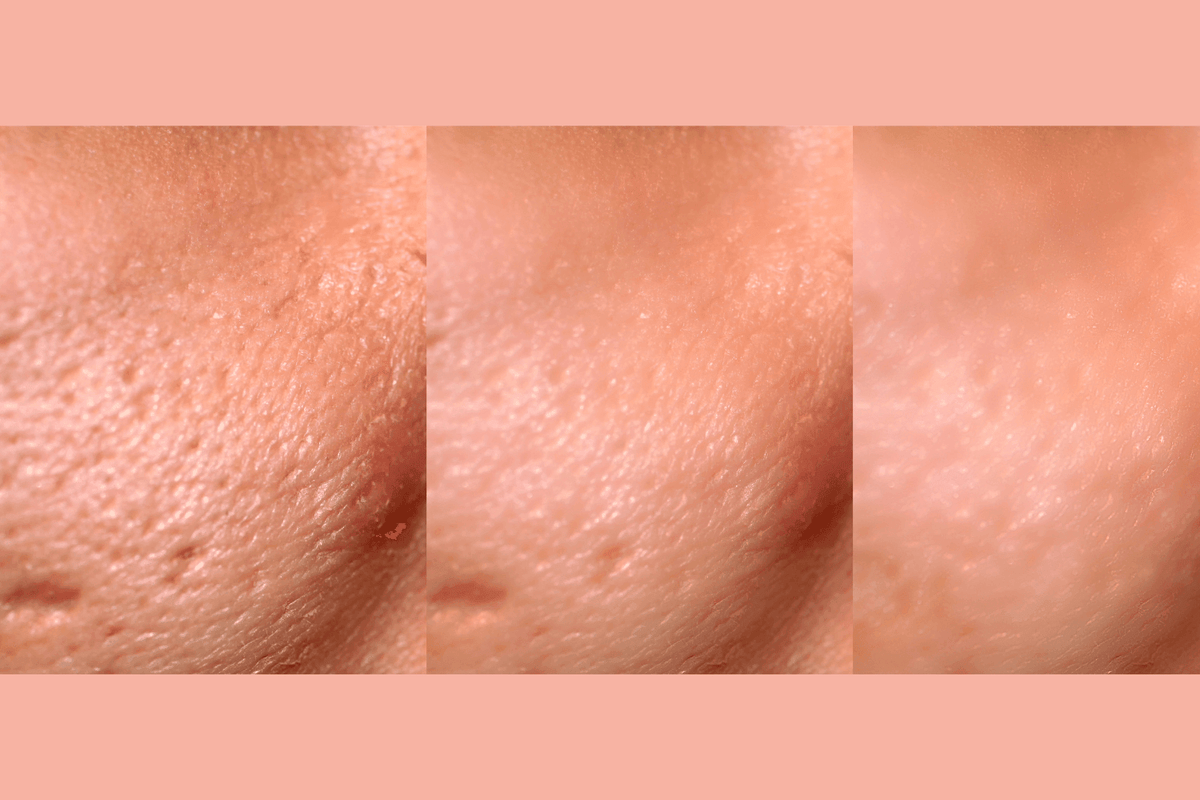 Ultra-Advanced Anti-Aging Daily Resurfacing Pads
