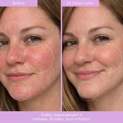THE PLACENTA FACIAL Dark Spot Serum + Barrier Repair Cream Bundle